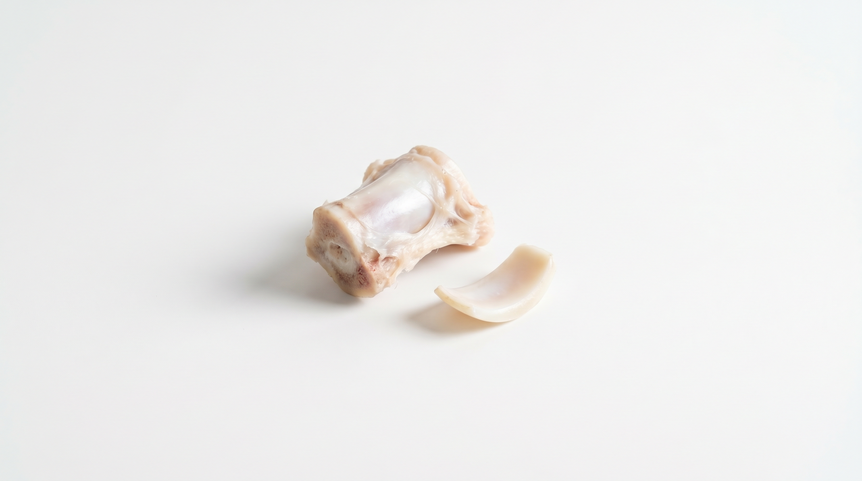 Beef cartilage, a natural source of chondroitin